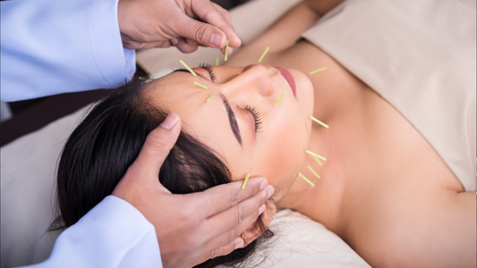 Harmonizing Beauty: Exploring the Benefits of Facial Acupuncture and Acupressure